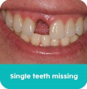 Kasmo-specialties-Prosthetic Dentistry (2)