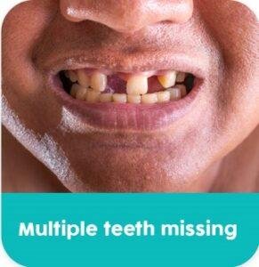 Kasmo-specialties-Prosthetic Dentistry (3)
