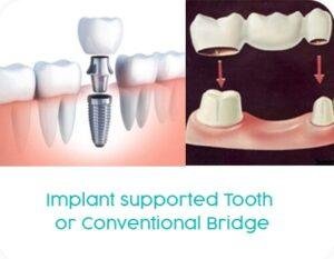Kasmo-specialties-Prosthetic Dentistry (6)