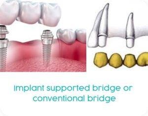 Kasmo-specialties-Prosthetic Dentistry (7)