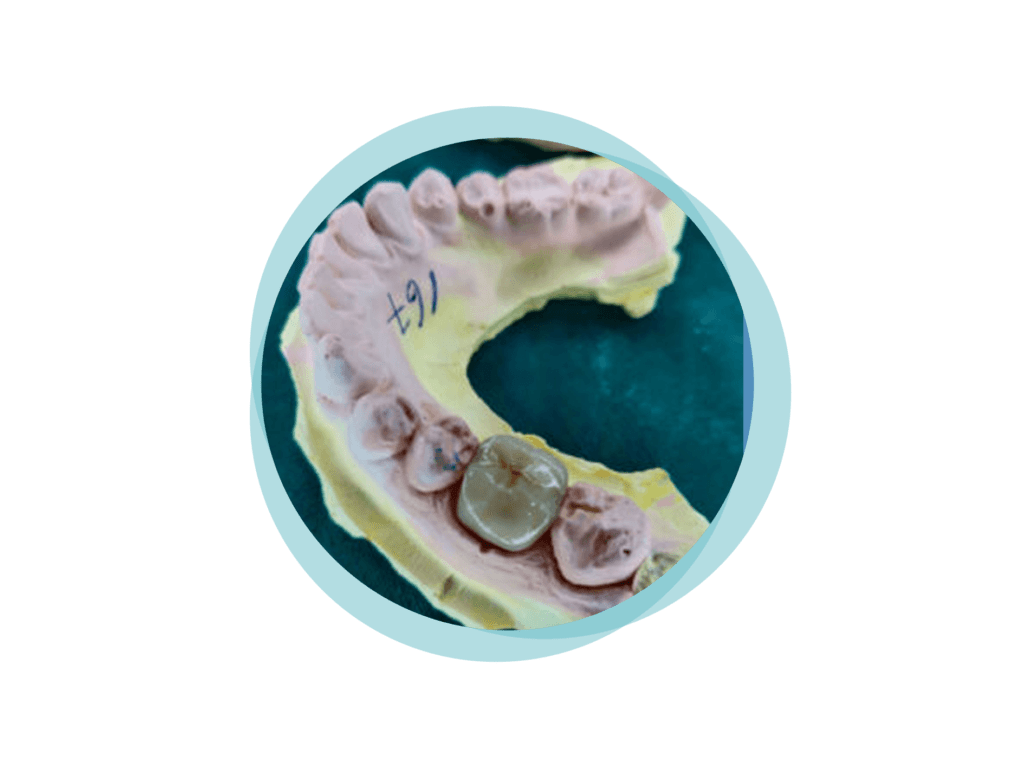 Implant Dentistry