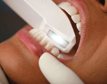 Implant Dentistry