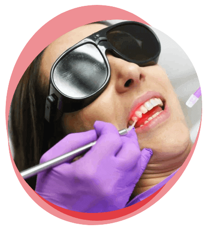 painless laser dental treatment in hyderabad