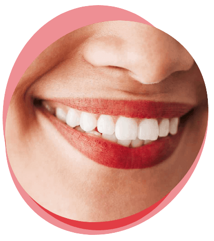 smile make over treatment cost in hyderabad