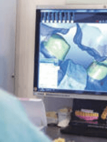 Implant Dentistry