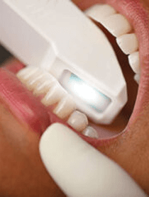 Implant Dentistry